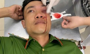 Bình Thuận: Đại úy Công an bị thương khi truy bắt đối tượng ma túy trong đêm