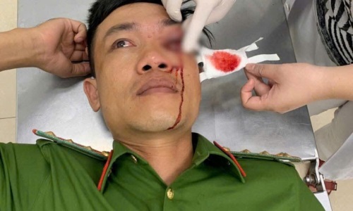 Bình Thuận: Đại úy Công an bị thương khi truy bắt đối tượng ma túy trong đêm